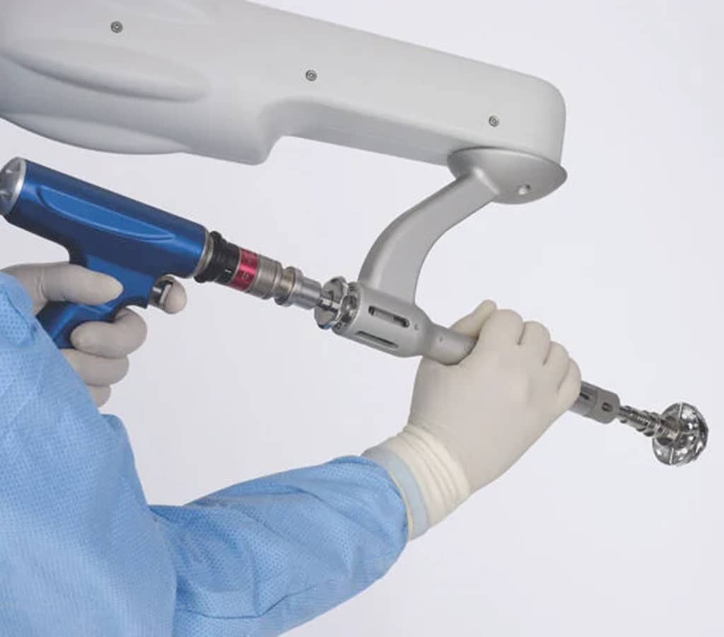 MAKO Robotic Arm Computer Assisted Surgery